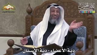 2298 - ديّة الأعضاء - ديّة الأسنان - عثمان الخميس