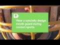 How to Prevent Concussions