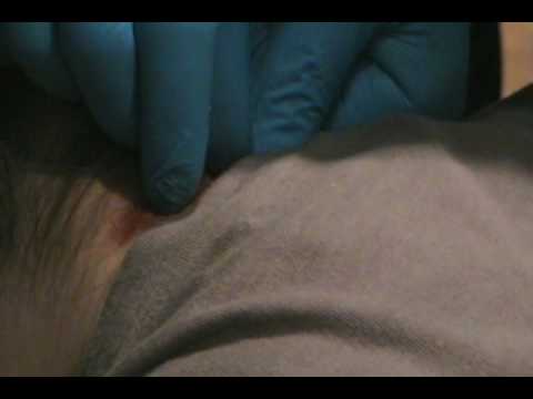 hip piercing video. My Hip Piercing