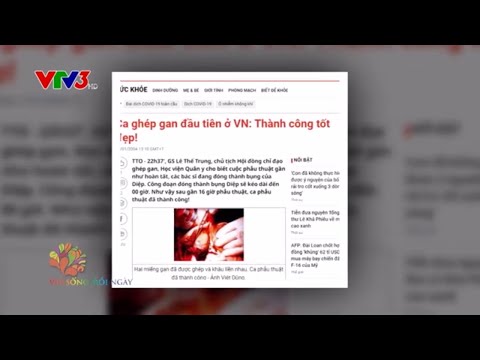 Khi nào cần ghép gan
