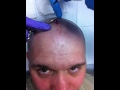 Horn removal