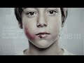 Anar Foundation against child abuse needs funds urgently