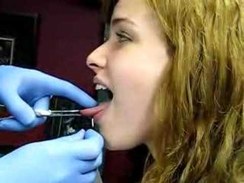 infected tongue piercings. Infected Tongue Piercing