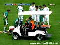 Worst Football (Soccer) Injury Ever - #7