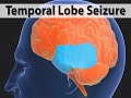 Types of Seizures (Epilepsy #2)