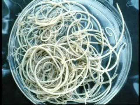 maggots in brain. Monsters Inside Me - Maggots