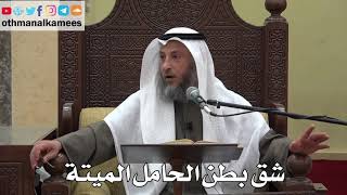 961 - شق بطن الحامل الميتة - عثمان الخميس - دليل الطالب