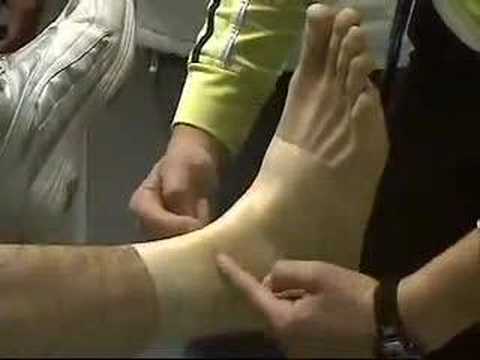 inversion ankle sprain. Kt Tape: Ankle Sprains