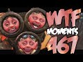 Dota 2 WTF Moments 467