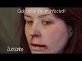 FX MAKEUP SERIES: Zombie Bite