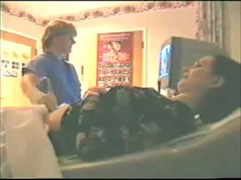 sonography test for pregnancy. NUCHAL TRANSLUCENECY TEST