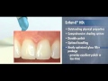 Esthet-X® HD—The High-Definition Matrix for Artful Restorations: Chapter 2  | Dentsply Sirona