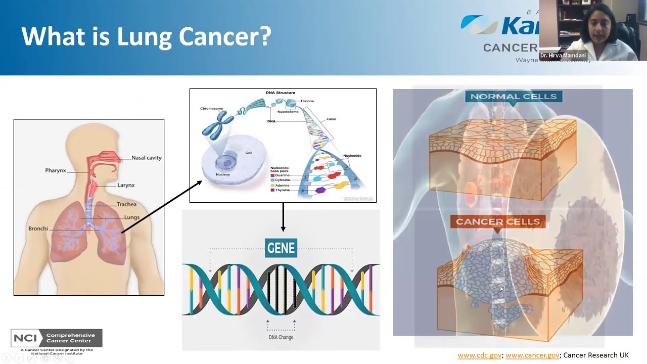Lungs are Important: Know Your Risks for Cancer video thumbnail
