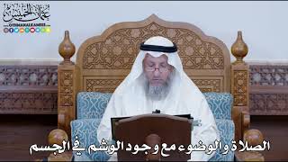 1269 - الصلاة والوضوء مع وجود الوشم في الجسم - عثمان الخميس