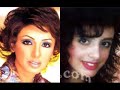 لن تصدق شكل الفنانات المصريين والعرب قبل وبعد عمليات التجميل سبحان مغير الأحوال