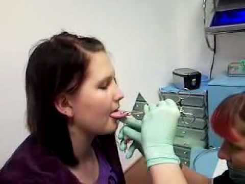 infected tongue piercings. Infected Tongue Piercing