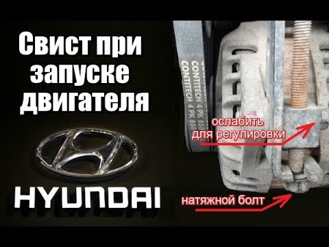 При запуске двигателя свист писк Hyundai (Хендай)