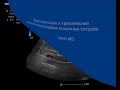 Нажмите для просмотра : Дуплексная и триплексная допплерография почечных сосудов