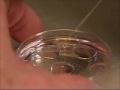 In Vitro Fertilization procedure.