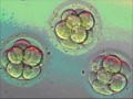 In Vitro Fertilization procedure.