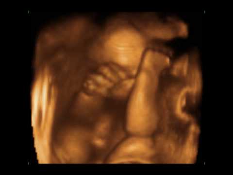 3d ultrasound pictures of twins. Charlotte 3D 4D Ultrasound