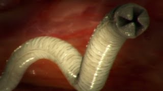 Ascaris Digestive System