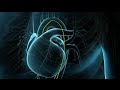 Heart Animation: Coronary Artery Angioplasty (Heart Stent)