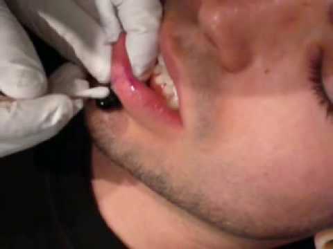 matt getting his labret punched to "00" the music is: sage francis / black 