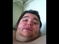 Overweight guy asks for help