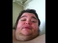 Overweight guy asks for help