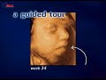 Baby Steps: 4D Ultrasound