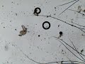Rotifer Movement