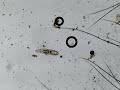 Rotifer Movement