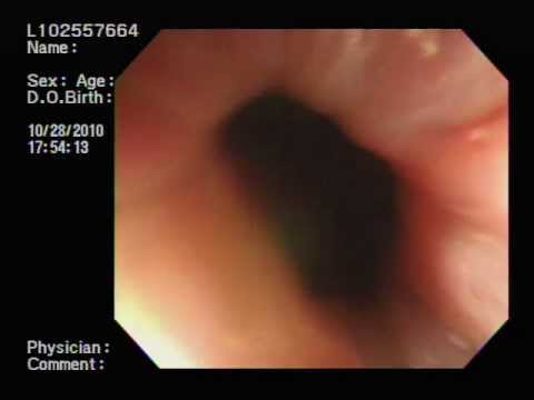 胃腸內視鏡 pic