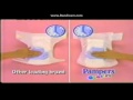 Pampers Comfort Philippines Commercial 1998
