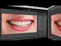 Fix Teeth in Photoshop and Lightroom!