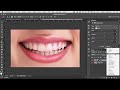 Fix Teeth in Photoshop and Lightroom!