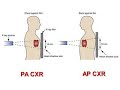 cardiac X ray   by Dr Ahmed Shabana