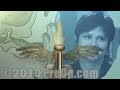 Coronary Artery Bypass (CABG) Surgery