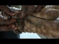 Uncountable number of parasites in a Mastiff-Mix in The Gambia
