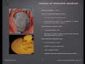 Nuclear weapons and Iran Lecture