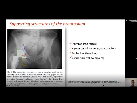 Video 1: Dr. Loris Perticarini / 12:50 thumbnail