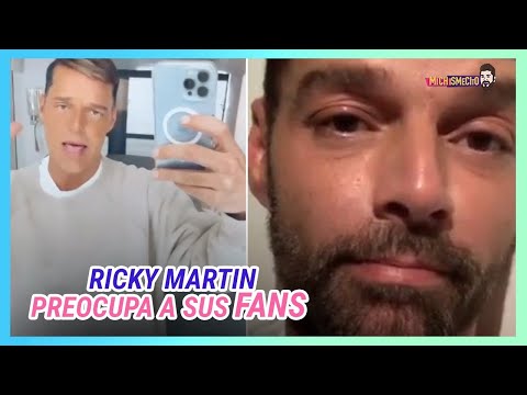Ricky Martin le llueven críticas por la apariencia de su rostro