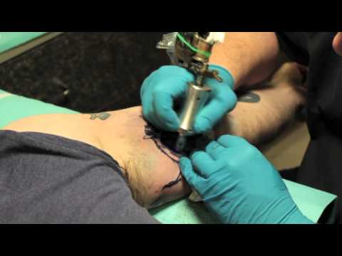 Billy Hill's Tattoo TV Special Episode Does Nuviderm Work