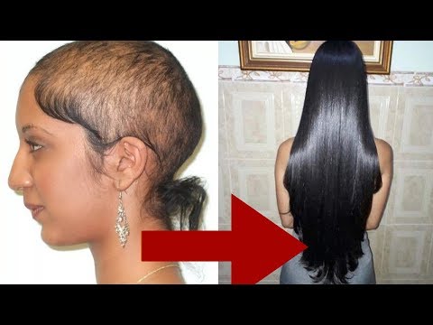 Download Thumbnail For One Oil That Will Stop Your Hair Fall And