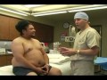 Video: AZLipo TumLipoProc AbsAlexWalker