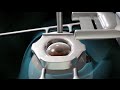 3D Medical Animation: LASIK Eye Surgery for Nearsightedness