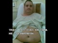 BYPASS GASTRICO ( ANTES Y DESPUES)