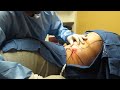 Video: SmartLipo-Love handles-Liposuction Muffin top-Liposuction Flanks-Valley Aesthetics