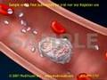 Clot Formation and Clot Breakdown: 2D Medical Animation